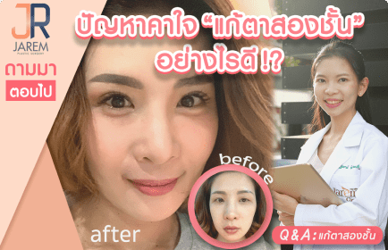 ปัญหาคาใจ “แก้ตาสองชั้น”อย่างไรดี?