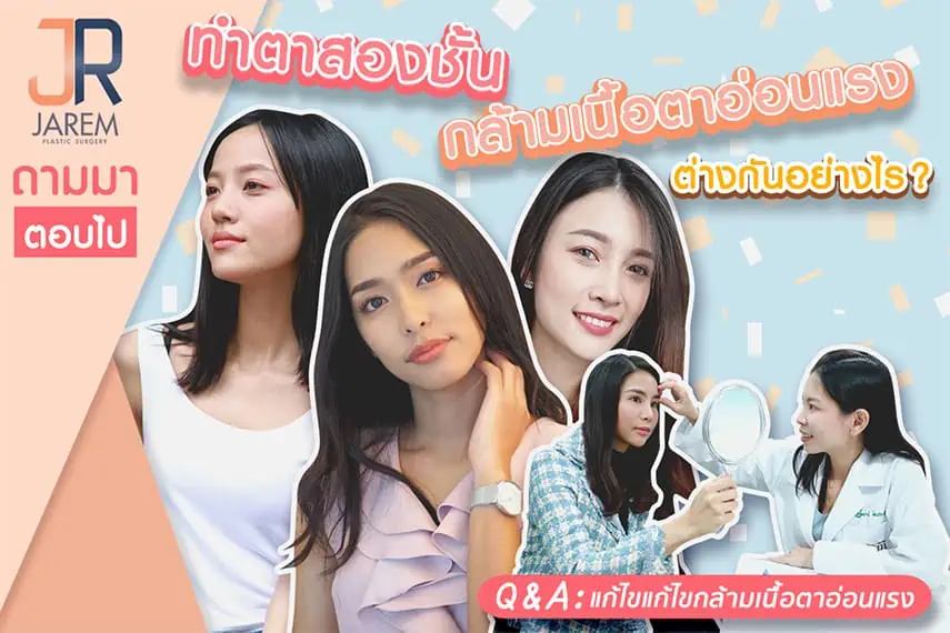 ปกบทความทำตาสองชั้นต่างกับแก้ไขกล้ามเนื้อตาอ่อนแรงอย่างไร