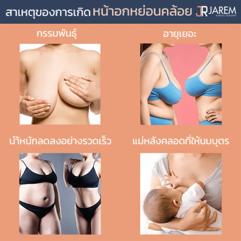 สาเหตุที่ทำให้หน้าอกหย่อนคล้อย