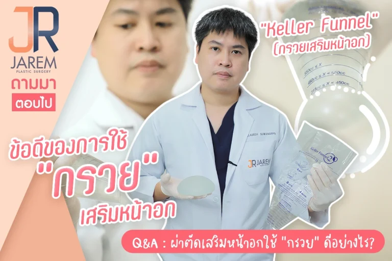 ข้อดีของการใช้กรวยใส่ซิลิโคน Keller Funnel ในเคสเสริมหน้าออก