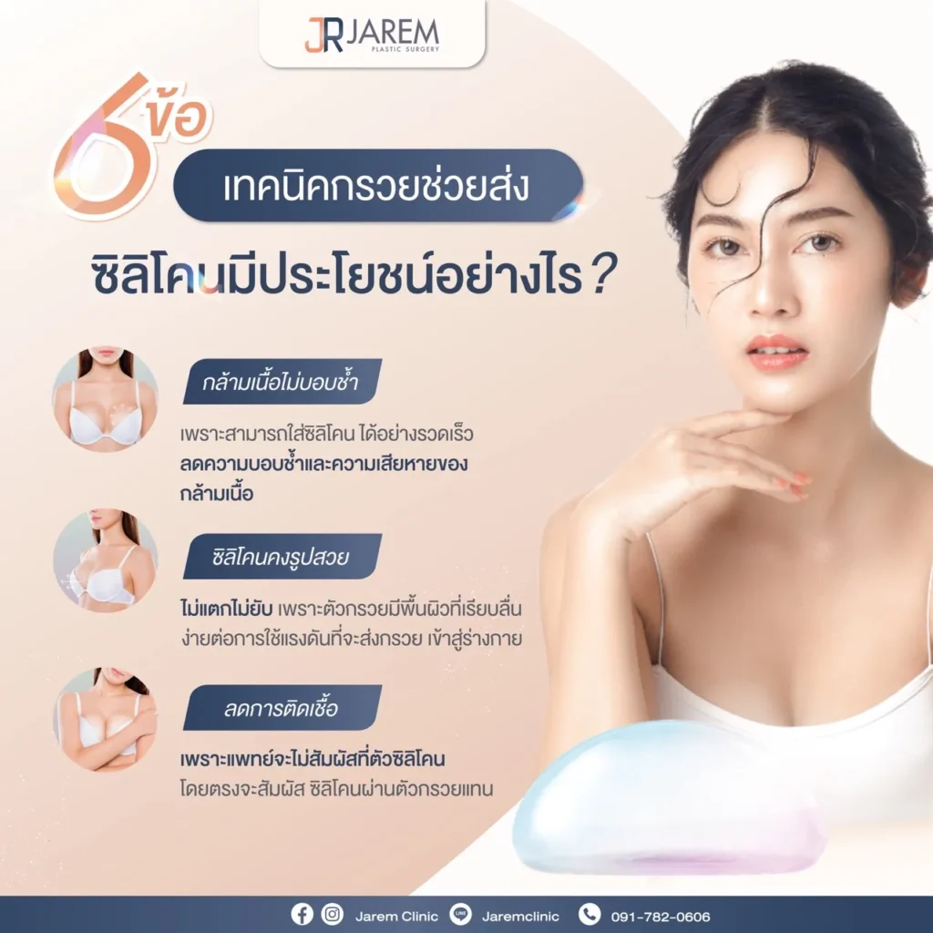 การใส่ซิลิโคนหน้าอกด้วยกรวย