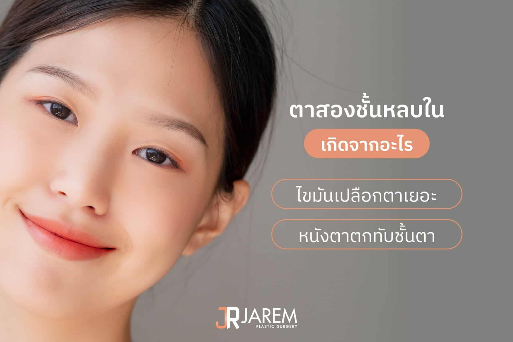 ปัญหาตาสองชั้นหลบในเกิดจากอะไร