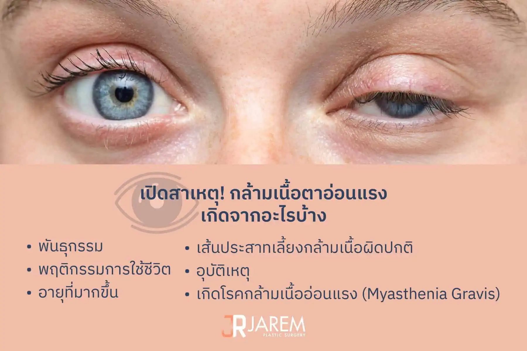กล้ามเนื้อตาอ่อนแรงเกิดจาก