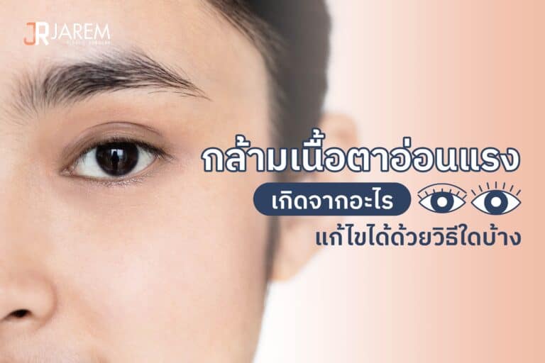 กล้ามเนื้อตาอ่อนแรงเกิดจากอะไร แก้ไขได้ด้วยวิธีใดบ้าง