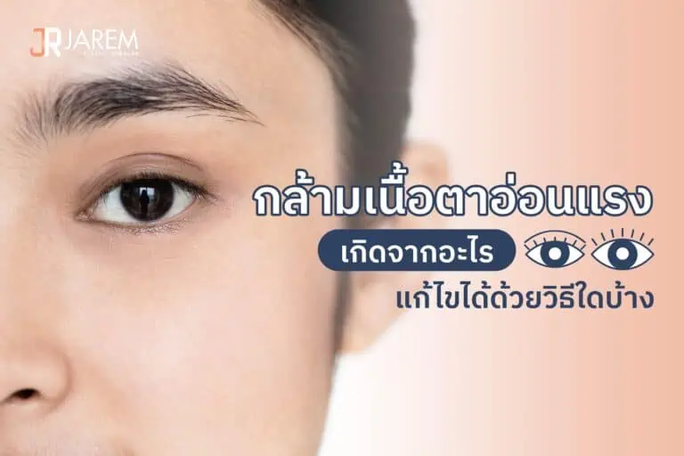 ปกบทความกล้ามเนื้อตาอ่อนแรง