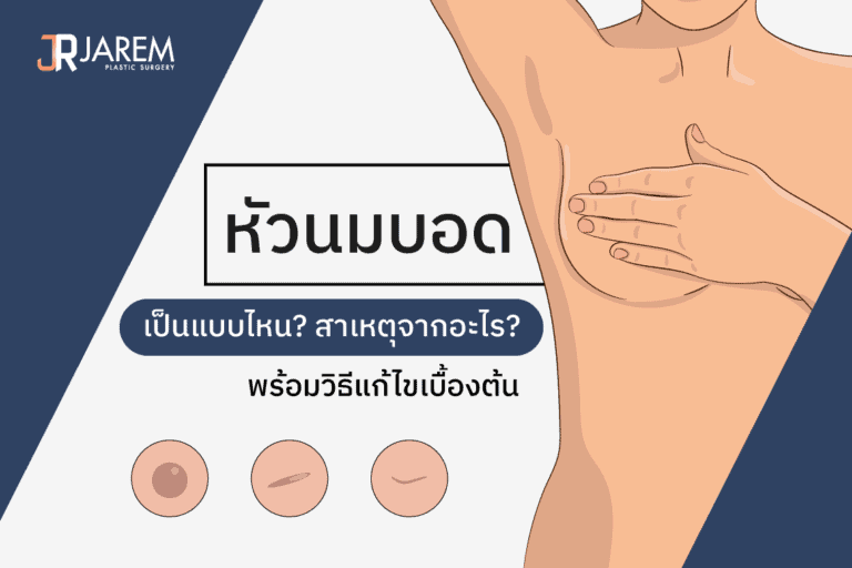 หน้าปกบทความหัวนมบอด