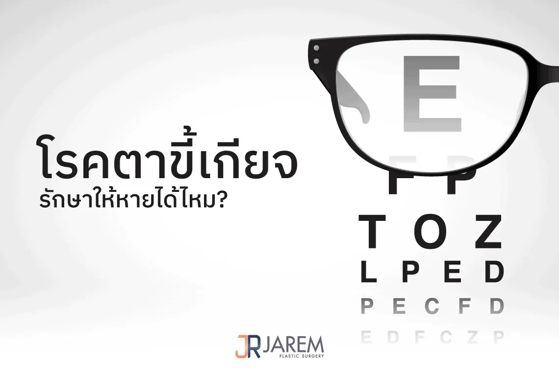 การรักษาโรคตาขี้เกียจ