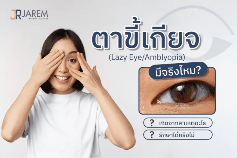 หน้าปกบทความโรคตาขี้เกียจ