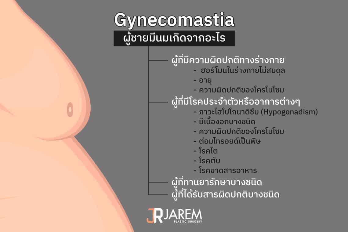 Gynecomastia ภาวะผู้ชายมีนมคืออะไร เกิดจากอะไร อันตรายหรือไม่