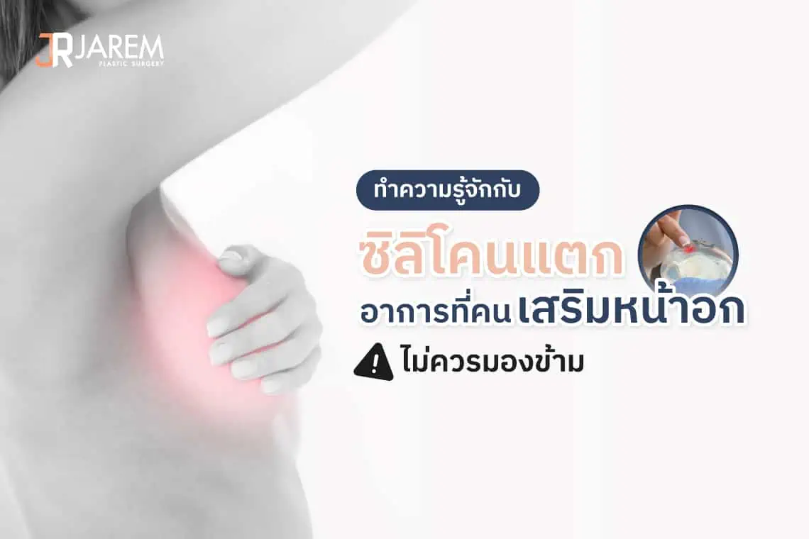 ปกบทความซิลิโคนเสริมหน้าอกแตก