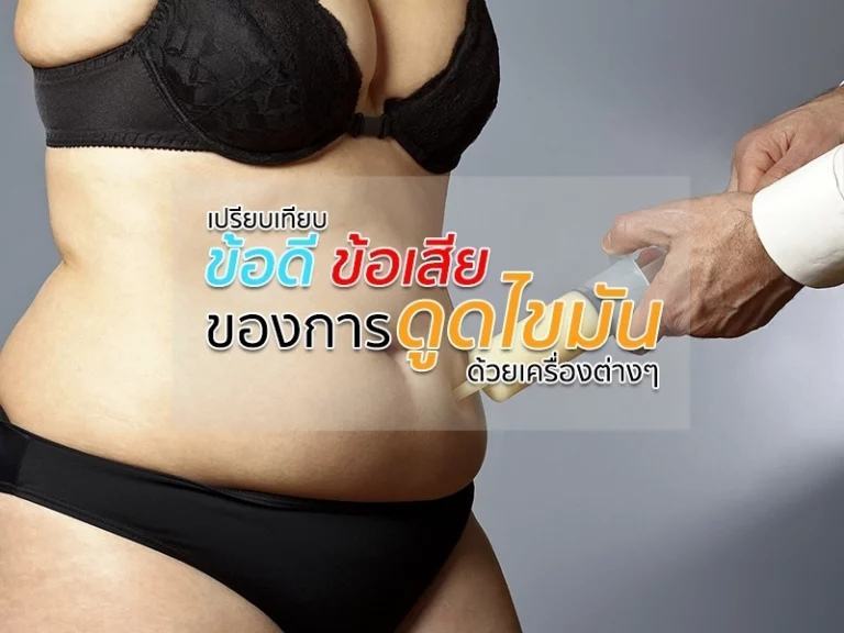 เปรียบเทียบข้อดีข้อเสียของการดูดไขมันด้วยเครื่องต่างๆ