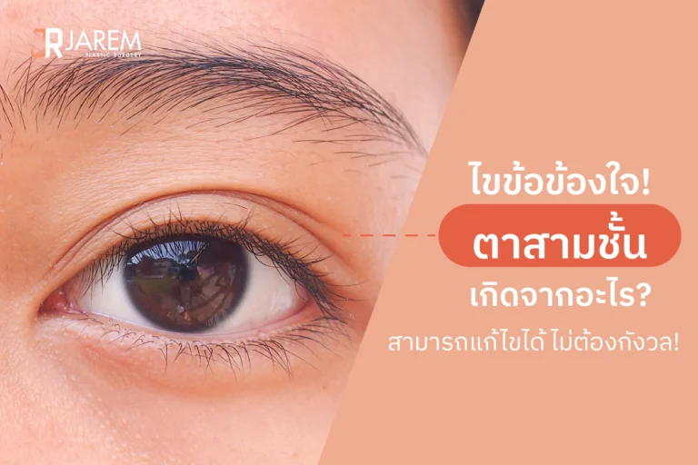 ไขข้อข้องใจ! ตาสามชั้นเกิดจากอะไร? สามารถแก้ไขได้ ไม่ต้องกังวล!