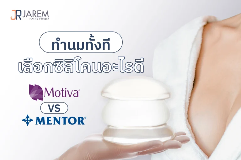 เสริมหน้าอกด้วยซิลิโคน Motiva และ Mentor มั่นใจ ปลอดภัยระยะยาว