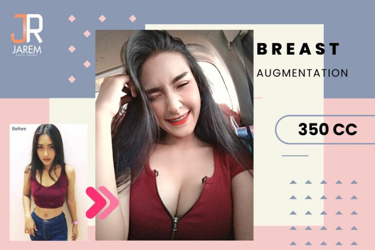 เสริมหน้าอกสวย