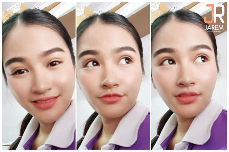 ตาปรือ ตาตก