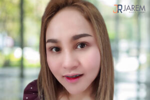 แก้ไขตาปรือ หนังตาตก ตาไม่เท่ากัน หน้าดุ หน้าเหวี่ยง