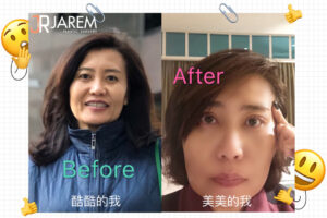 ทำตา2ชั้นอาจคิดว่าไม่ยาก แต่ทำให้สวยมากนั้นก็ไม่ง่าย