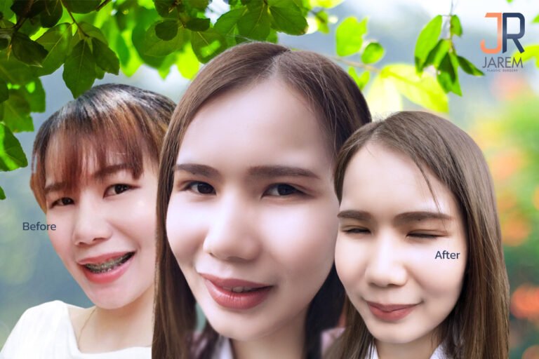 หนังตาตก