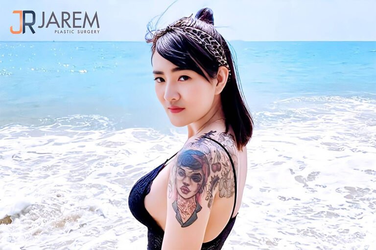 รีวิวเสริมหน้าอกสวย