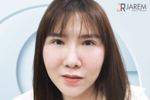 รีวิวแก้ตากับหมอยุ้ย จักษุแพทย์เฉพาะทาง ที่จาเรมคลินิก