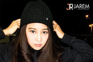 ศัลยกรรมแก้ไขชั้นตา ปรับชั้นตาให้เป็นธรรมชาติ ที่จาเรมคลินิก