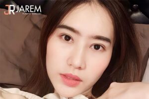 อยากรักษากล้ามเนื้อตาอ่อนแรง เลือกทำตาที่ไหนดี?