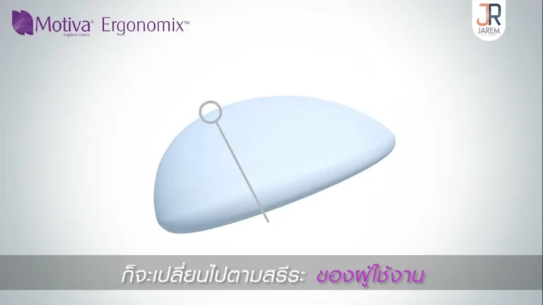 ซิลิโคน motiva ergonomix รุ่นมีชิพดียังไง?ทำไมทรงสวย