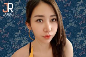 แก้ไขกล้ามเนื้อตาอ่อนแรง เบ้าตาลึก ด้วยเทคนิคย้ายไขมันในตา