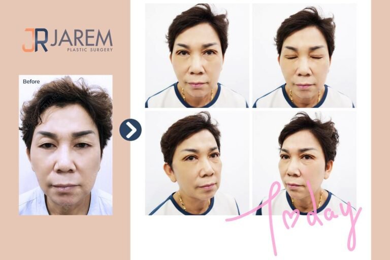 ตาชั้นเดียว