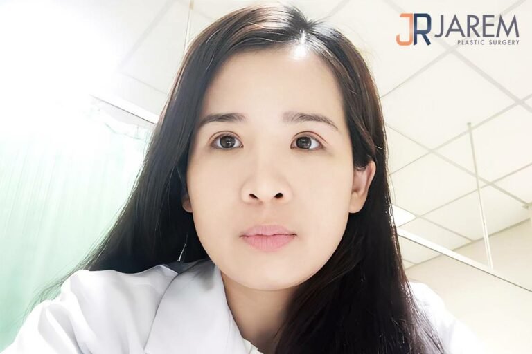 แก้ตาสองชั้นที่ไหนดี