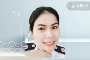 มีชั้นตา แต่ตาปรือ ตาง่วงนอน คืออาการอะไร? แก้ไขอย่างไรดี?