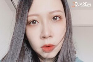 รีวิวแก้ไขตาปรือ หนังตาตก ด้วยการผ่าตัดแก้ไขกล้ามเนื้อตาอ่อนแรง