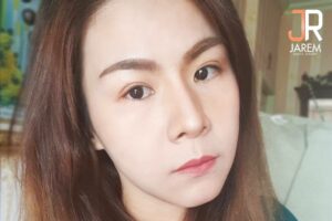 กล้ามเนื้อตาอ่อนแรงแต่กำเนิด และภาวะที่ทำให้เกิดโรคตาขี้เกียจ