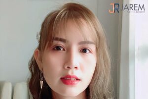 แก้ตา2ชั้นที่ไหนดี แก้ตาครั้งนี้ต้องเลือกจักษุแพทย์เฉพาะทาง