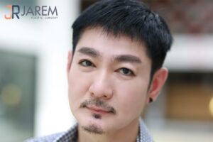 รีวิวแก้ตาตก เปลี่ยนตัวเองให้ดูเด็กลง หลังรักษากล้ามเนื้อตาอ่อนแรง