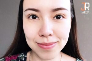 เปลี่ยนชั้นตาหลบใน เป็นตาสองชั้นสวยๆ ที่จาเรมคลินิก