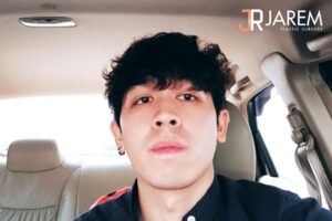 “ตาลอย” เกิดจากอะไร? ใช่กล้ามเนื้อตาอ่อนแรงหรือไม่?