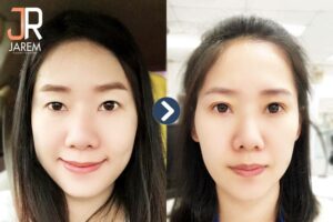 เปลี่ยนตาหลบใน เป็นตาสองชั้นอย่างไรไม่ให้โป๊ะ!