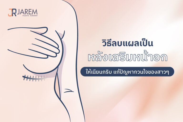 วิธีลบแผลเป็นหลังเสริมหน้าอก ให้เนียนกริบ แก้ปัญหากวนใจของสาวๆ