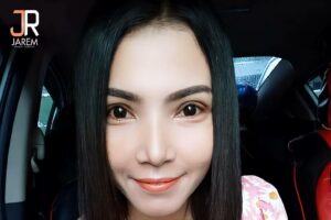 แก้ไขชั้นตาสูง ชั้นตาหนา เบ้าตาลึก กล้ามเนื้อตาอ่อนแรง ที่จาเรมคลินิก