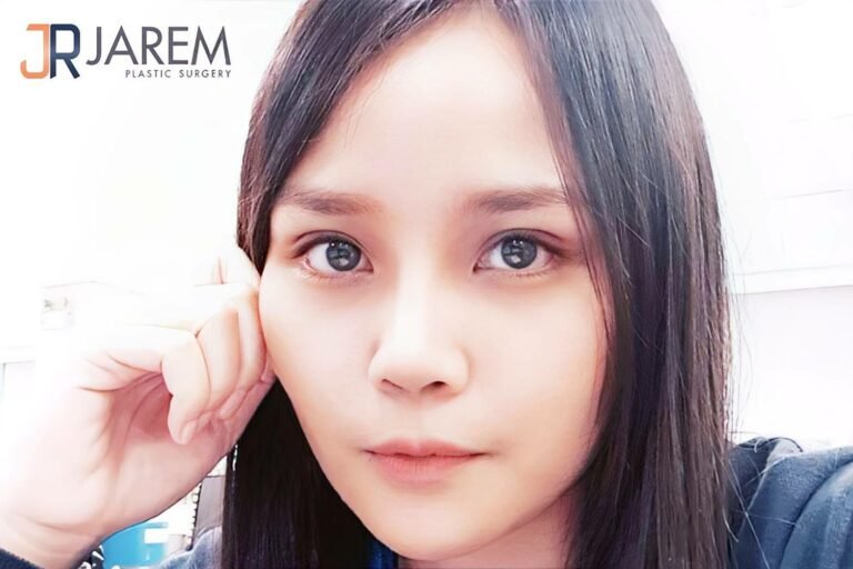 ตาหลายชั้นแก้ยังไง