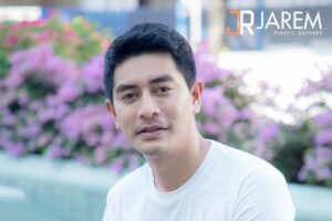 ประสบการณ์แก้ไขกล้ามเนื้อตาอ่อนแรงแต่กำเนิด ครั้งที่ 2