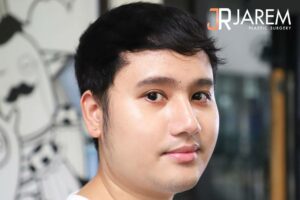 แก้ไขชั้นตาหลบในที่ไหนดี? อยากให้ชั้นตาเท่ากันและดูเป็นธรรมชาติ