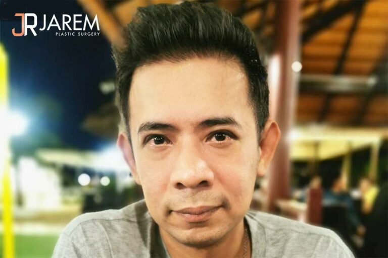 กล้ามเนื้อตาอ่อนแรงในผู้ชายวัย 40+