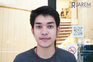 ตาปรือ ดูง่วงนอน ลืมตาไม่ขึ้น คืออะไร? แก้ไขได้อย่างไร?