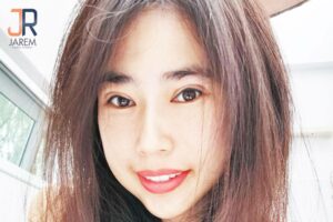 รีวิวแก้ตา..จากปัญหากล้ามเนื้อตาอ่อนแรงหลังทำตาสองชั้น