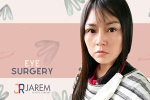 รีวิวการแก้ไขหนังตาหนา หนังตาตก ตาง่วงนอนและกล้ามเนื้อตาอ่อนแรง