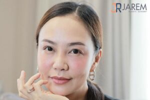 “ตาหอยแครง” ปัญหาชั้นตาหนาของคนทำตาสองชั้นที่แก้ไม่ตก