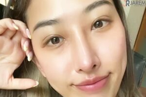 ทำตาสไตล์เกาหลี พร้อมแก้ไขกล้ามเนื้อตาอ่อนแรงแต่กำเนิด