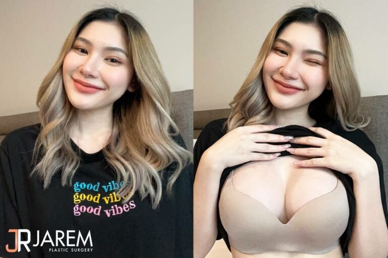 เสริมหน้าอกสวยๆ